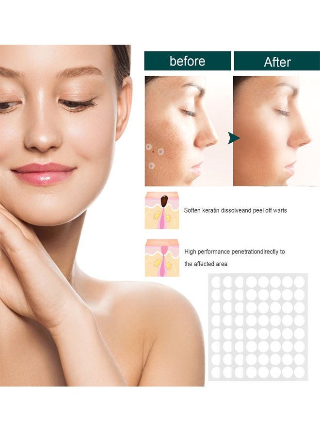 120 Pcs Skin Tag Remover Patches, Made with Natural Ingredients Skin Friendly Breathable and Reliable to Use Fast Use Effect, Compact Design and Lightweight Make It Portable and Space Saving
