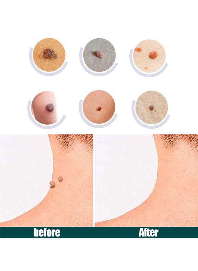 120 Pcs Skin Tag Remover Patches, Made with Natural Ingredients Skin Friendly Breathable and Reliable to Use Fast Use Effect, Compact Design and Lightweight Make It Portable and Space Saving