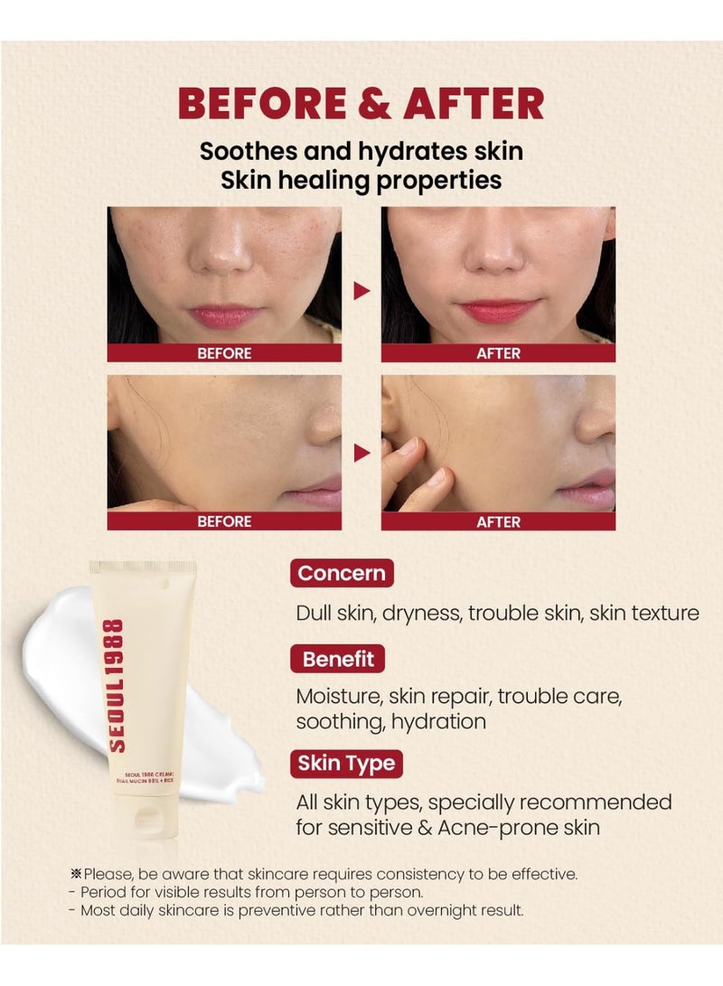 DubaiGallery Seoul1988 Snail Mucin Face Cream | 93% Snail Extract + Rice | Korean Beauty Moisturizer for Even Tone & Soft Skin - Image 3