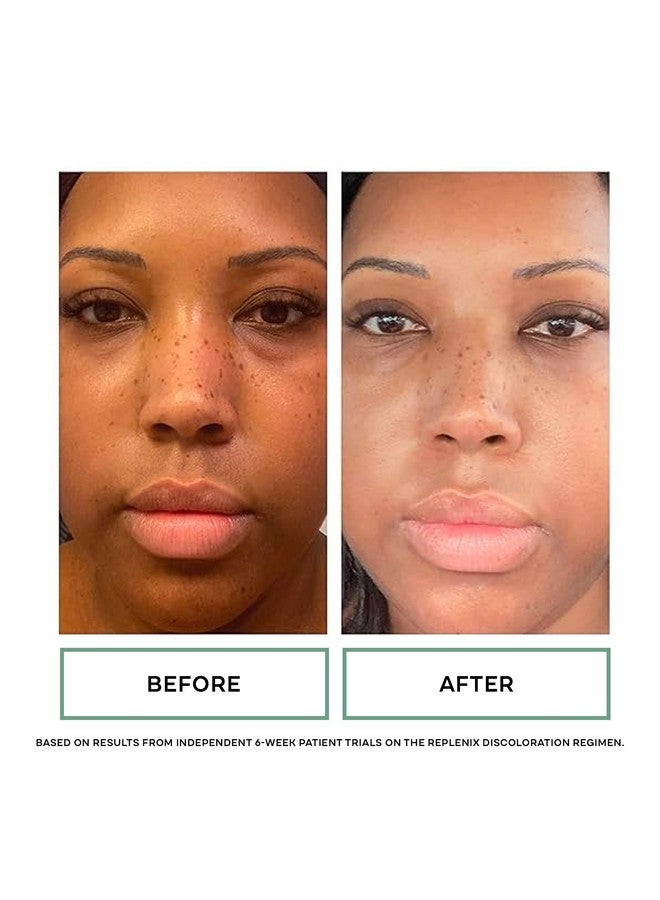 Replenix Vitamin C Pro Collagen Serum, Brightening Anti-Aging Face Treatment with Medical-Grade Antioxidants for Skin Discoloration (0.24 fl oz) - Image 5