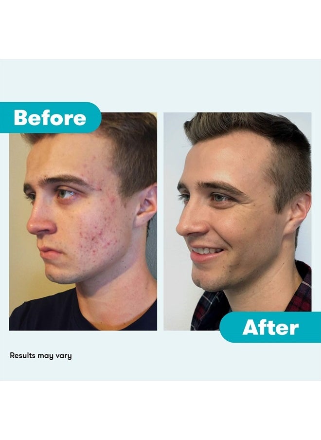 Proactiv - 3 Step Acne Treatment System, Cleanser, Toner and Repair (60+60+30) - Image 1