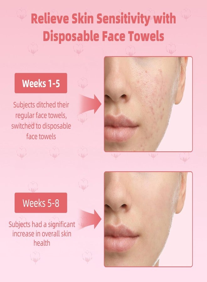 ICOTLE Disposable Face Towels, 10"×12" Facial Towelettes Disposable, Makeup Remover Dry Wipes for Sensitive Skin, Makeup Removing, Cleansing, Nursing, Travel - Image 4