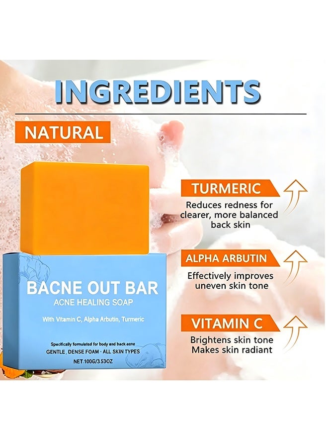 OceAura Bacne Out Bar, Acne Healing Soap With Turmeric Vitamin C & Alphaarbutin, Natural Exfoliating Cleanser For Back, Face, Chest, Shoulders, Tumeric Soap For Acne, Dark Spots, Hyperpigmentation, Smooth Skin, 100g - Image 5