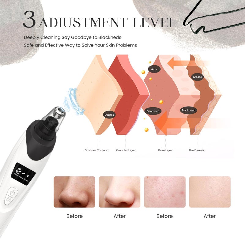 Gackoko 2025 Blackhead Remover Pore Vacuum,Facial Pore Cleaner-5 Suction Power,5 Probes,USB Rechargeable Blackhead Vacuum Kit Electric Acne Extractor Tool for Adult (Black) - Image 3