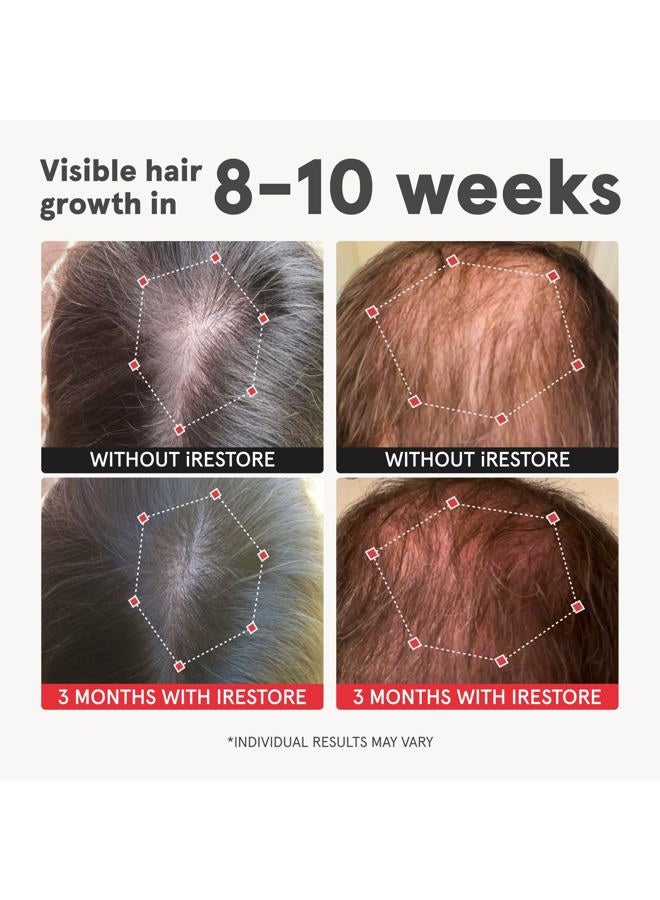 iRestore Advanced Hair Growth Supplement for Women with Lustriva, Hair Vitamins for Faster Hair Regrowth, Best for Hair Loss and Thinning, 1 Month Supply - 1 Count (Pack of 1) - Black - Image 2