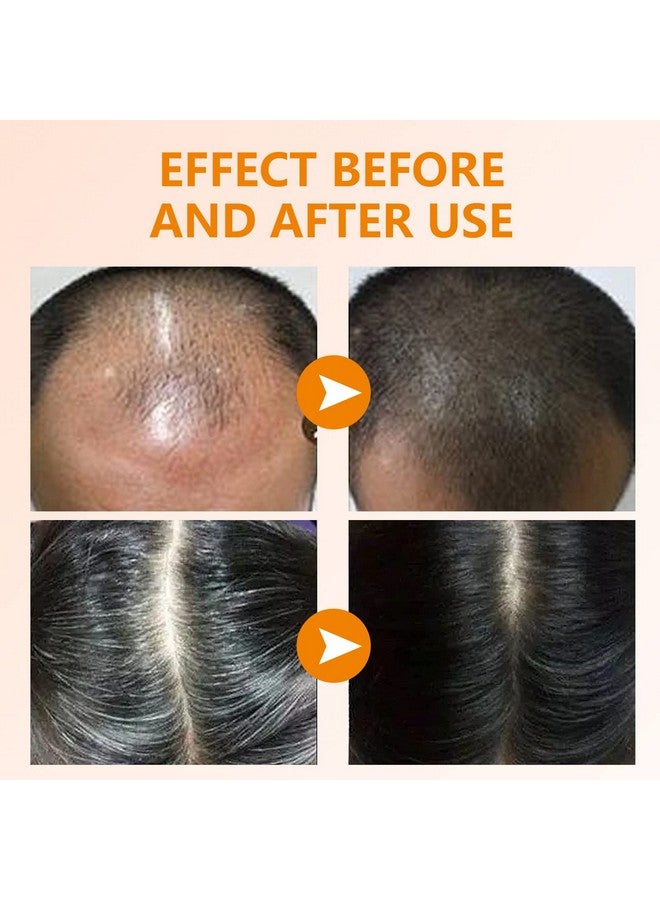 YAFUSIPE 2 Pack Ginger Turmeric Hair Regrowth and Growth Shampoo Bars, Natural Organic Solid with Ginger 4.23OZ/120g - Image 2