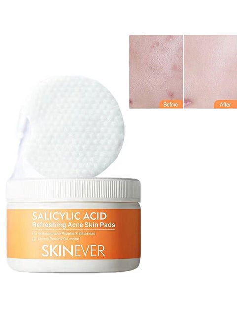 Salicylic Acid Refreshing Acne Skin Pads，2% Salicylic Acid Acne Pads, Acne Pads, Exfoliating Cleansing Wipes, Can Remove Dark Spots, Blackheads, Acne (30 Pieces)