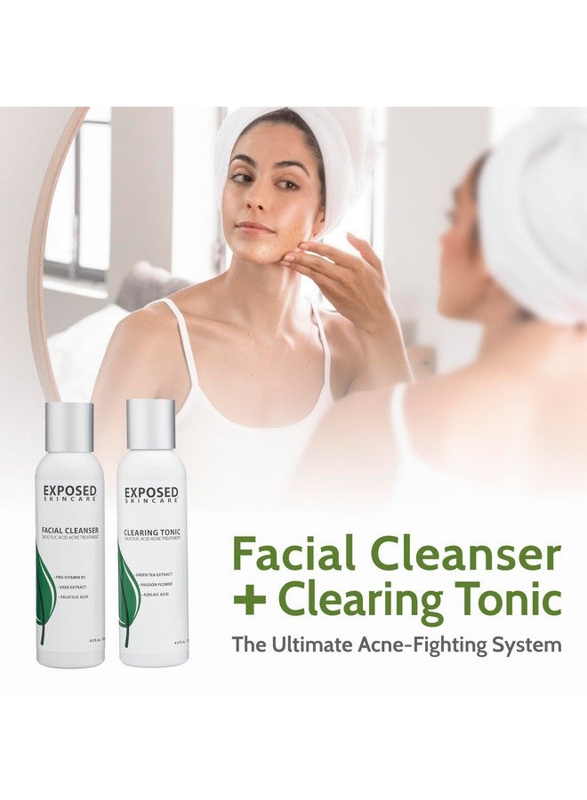 Exposed Skin Care Expanded Acne Treatment Kit - Includes Salicylic Acid Face Wash, Clearing Tonic, Treatment Serum With Benzoyl Peroxide, Clear Pore Serum, Moisture Complex - Made For All Skin Types - Image 3