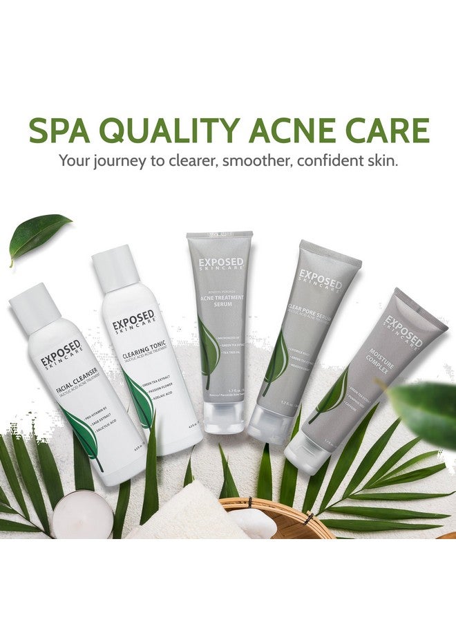 Exposed Skin Care Expanded Acne Treatment Kit - Includes Salicylic Acid Face Wash, Clearing Tonic, Treatment Serum With Benzoyl Peroxide, Clear Pore Serum, Moisture Complex - Made For All Skin Types - Image 2