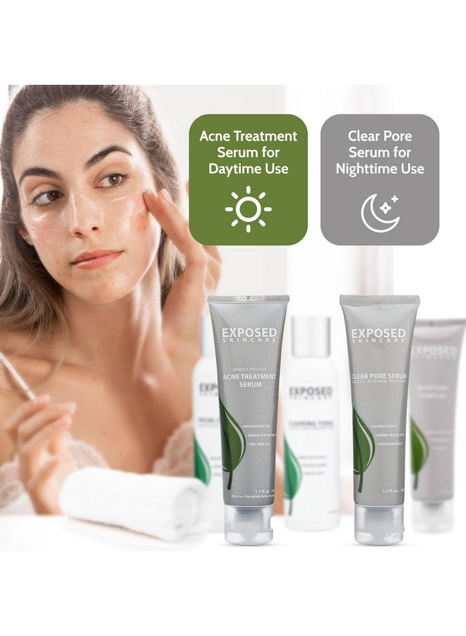 Exposed Skin Care Expanded Acne Treatment Kit - Includes Salicylic Acid Face Wash, Clearing Tonic, Treatment Serum With Benzoyl Peroxide, Clear Pore Serum, Moisture Complex - Made For All Skin Types - Image 4