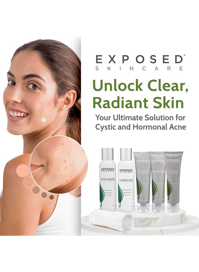 Exposed Skin Care Expanded Acne Treatment Kit - Includes Salicylic Acid Face Wash, Clearing Tonic, Treatment Serum With Benzoyl Peroxide, Clear Pore Serum, Moisture Complex - Made For All Skin Types - Image 5