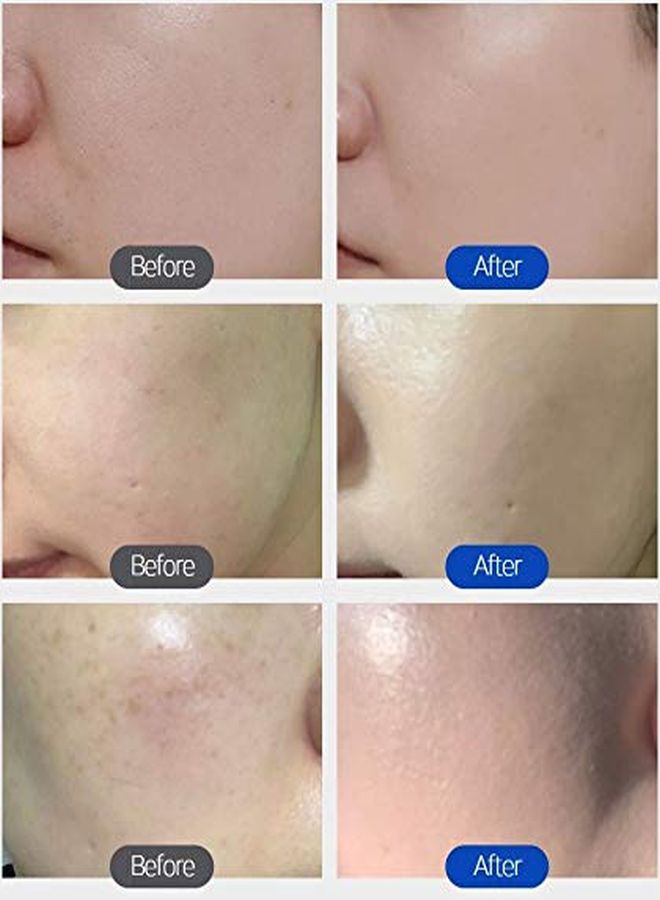 TROIAREUKE Aesthetic Bb Cream A+ Formula (21 Beige) Spf30 Pa+++, Lightweight Blemish Balm, Tinted Moisturizer With Medium Coverage, Lasting Foundation Makeup Base For Oily Skin | Korean Beauty Makeup  - Image 5