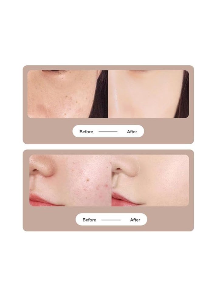 Generic - Skin Tag Removal Pen, Mole Removal Pen with LCD Display 9 Modes Replaceable Needles Freckles Dark Spots Aging Marks - Image 1
