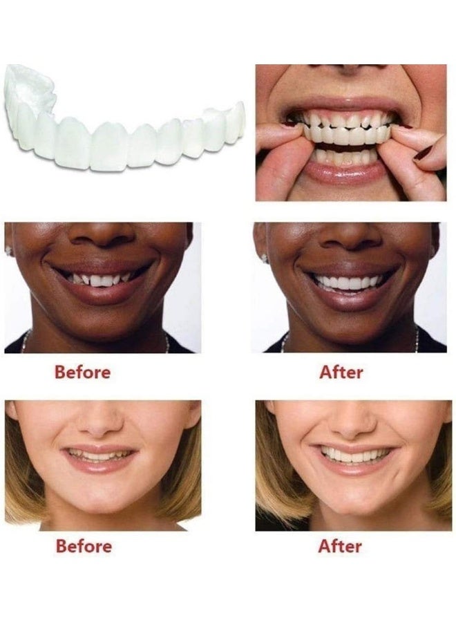 Generic 5 Pair Cosmetic Tooth, Top And Bottom Denture Fake Teeth Veneer, Snap in Dental Veneers Replacement Kit for Real Teeth  - Image 2