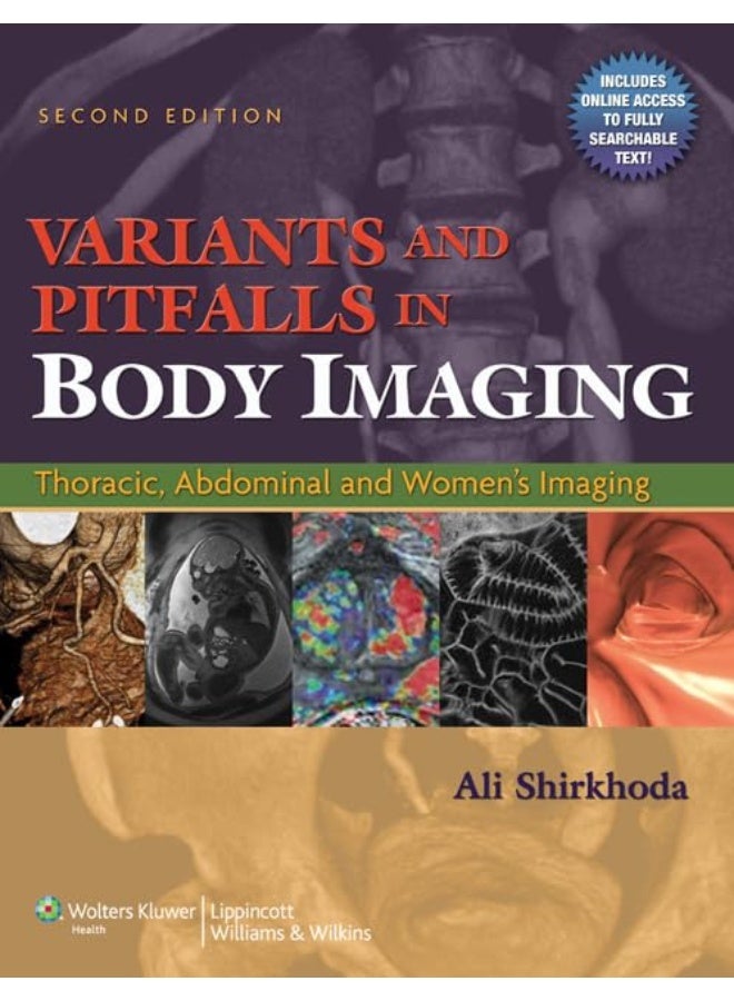 Variants and Pitfalls in Body Imaging: Thoracic, Abdominal and Women's Imaging  - Image 1