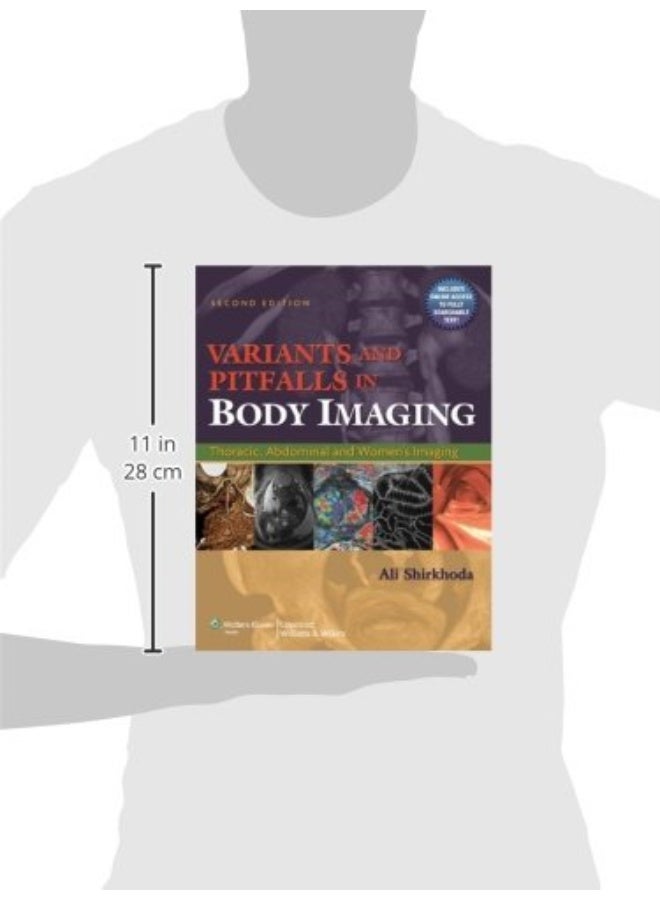Variants and Pitfalls in Body Imaging: Thoracic, Abdominal and Women's Imaging  - Image 2