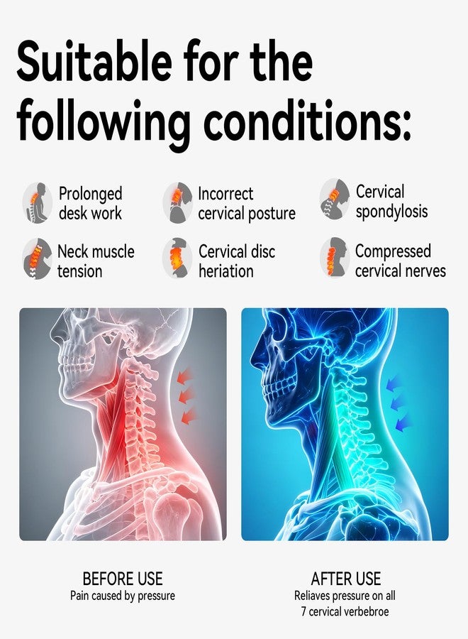 Owlprince Posture Corrector for Neck & Cervical Spine Alignment - 360° Adjustable Neck Collar with 28 Levels, Memory Foam Support for Pain Relief, Tech Neck, Hump & Forward Head Posture (Gray, Large) - Image 2