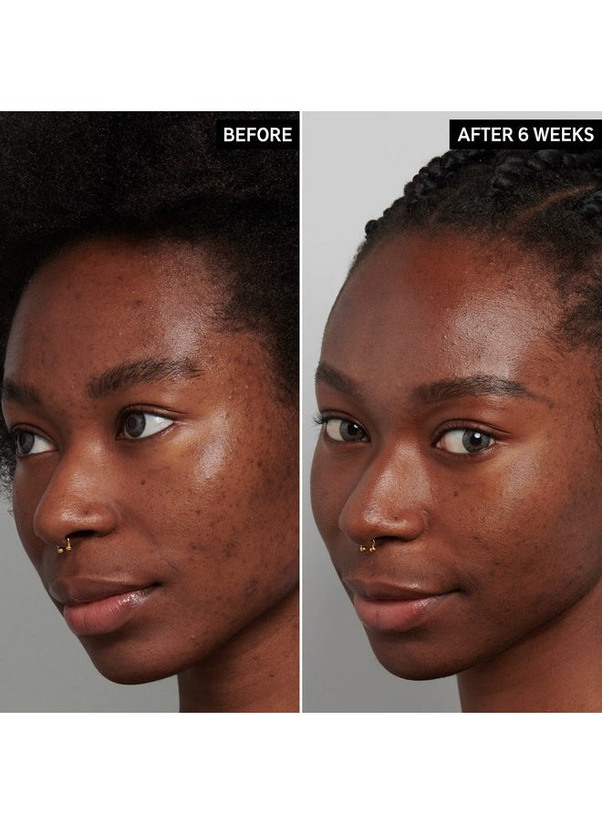 The Inkey List The INKEY List Tranexamic Acid Serum, Helps Reduce Appearance of Skin Discoloration, Dark Spots and Uneven Patches, Healthy-Looking Skin Tone, 1 fl oz  - Image 2