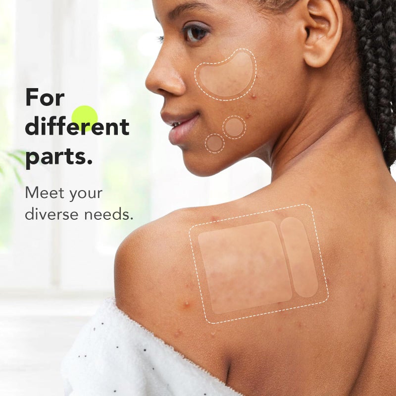 LitBear Large Pimple Patches (7 Sizes 306 Patches), Big Acne Patches, XL Hydrocolloid Bandages for Full Face, Forehead, Chin, Nose, Body, Back, Neck & Chest, Oval, Moon, Square hydrocolloid Patch - Image 4