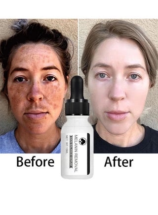 Niacinamide Serum, Face Whitening Dark Spot Corrector Serum, Whitening And Moisturizing Anti Aging Face Cream, Smooth Gentle Brightening Skin Care Serum For Skin Repairing - pzsku/ZD0970E5A565922063219Z/45/_/1715929969/b47bc9a9-a2ae-420c-912e-ad10cc36e905