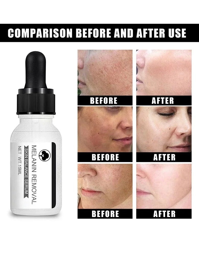 EELHOE - Niacinamide Serum, Face Whitening Dark Spot Corrector Serum, Whitening And Moisturizing Anti Aging Face Cream, Smooth Gentle Brightening Skin Care Serum For Skin Repairing - Image 1