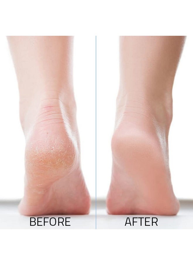 JAIRESTONE - Pumice Stone Callus Remover And Foot Stone Scrubber Exfoliating Foot Stone Pumice Rock For Hard Dry And Dead Skin On Heels Body Feet (Pack Of 2) (Multicolor) - Image 1