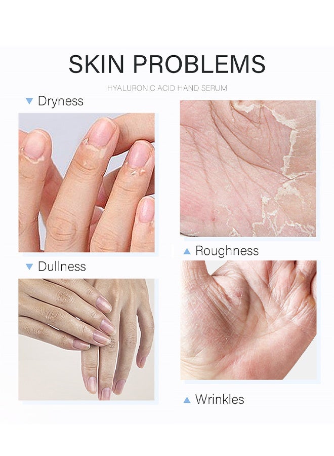 لايكو مصل اليدين حمض الهيالورونيك ، كريم مرطب لليدين ، كريم اليدين لجافة الأيدي ، كريم مرطب لليدين مضاد للشيخوخة ، كريم إصلاح اليدين غير الدهني وسريع الامتصاص 50 مل - Image 3