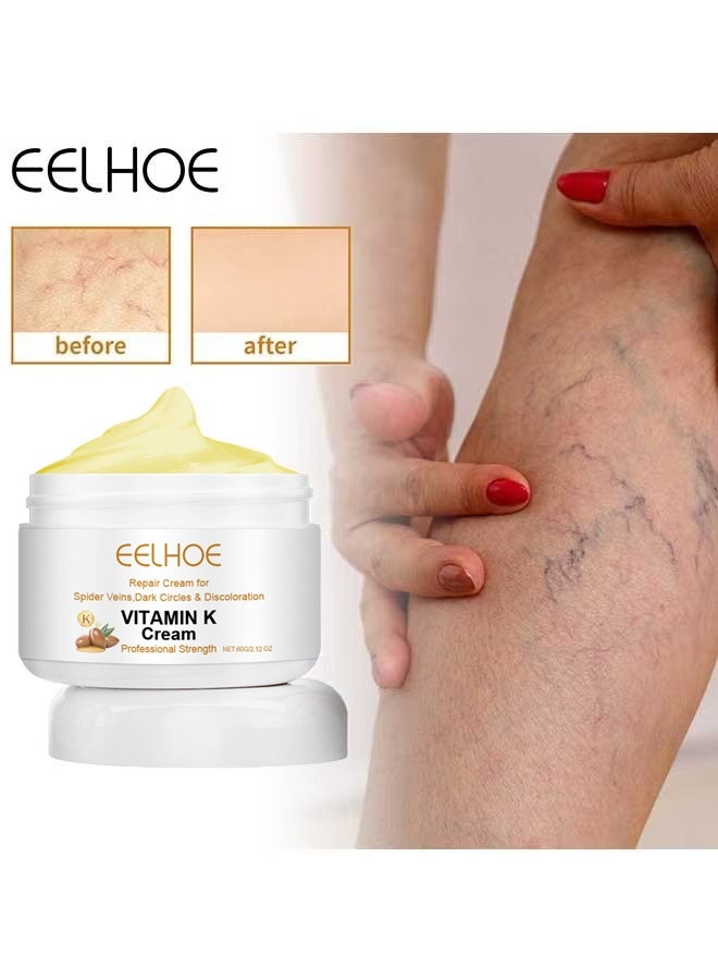 EELHOE Vitamin K Varicose Veins Cream, Soothing Leg Cream, Varicose and Spider Veins Treatment Cream, Improve Blood Circulation, Fast Relieve Swelling Pain 60g - Image 1