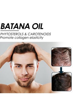 EELHOE Batana Oil for Hair Growth  Batana Oil - Batana Oil Organic for Healthy Hair - Repair Damaged Hair, Nourishes Thin Hair Scalp Skin and Loss Hair Growth Fir for All Hair Types - 30 ml  - Image 4
