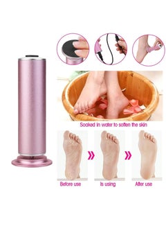 Milatech Electric Callus Remover, Foot File Pedicure Tool with Speed Controller and 60pcs Replacement Sandpaper Disk for Men Women Dead Dry Crack Skin Calluses  - Image 2