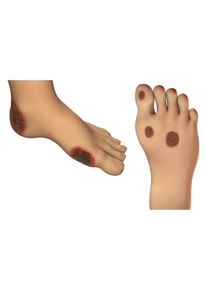 موف حذاء Rocking طويل لتعافي الإصابات وتحسين الحركة – MV086 موف - Image 4