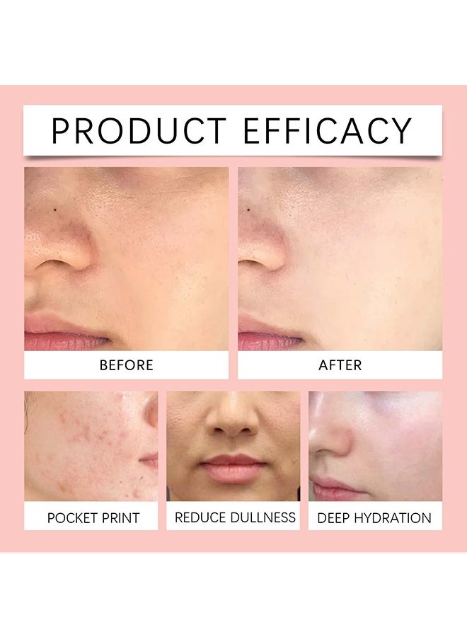 ك أو إي سي بخاخ للوجه، ماء الورد، بخاخ ماء الورد للوجه، رذاذ مرطب للوجه عضوي مع الجليسرين ومستخلصات النباتات، منعش للبشرة وغير دهني لترطيب فوري لجميع أنواع البشرة، يجدد وينقي البشرة 100 مل - Image 4