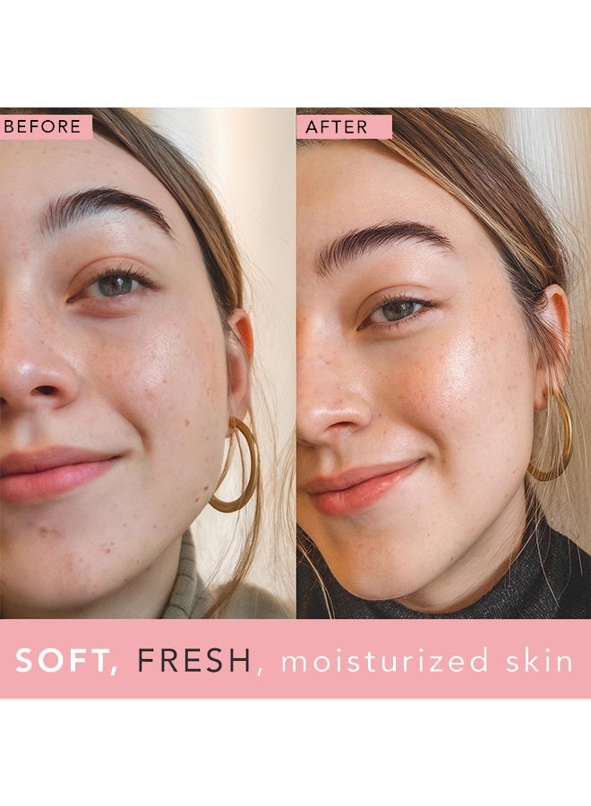 ك أو إي سي بخاخ للوجه، ماء الورد، بخاخ ماء الورد للوجه، رذاذ مرطب للوجه عضوي مع الجليسرين ومستخلصات النباتات، منعش للبشرة وغير دهني لترطيب فوري لجميع أنواع البشرة، يجدد وينقي البشرة 100 مل - Image 5