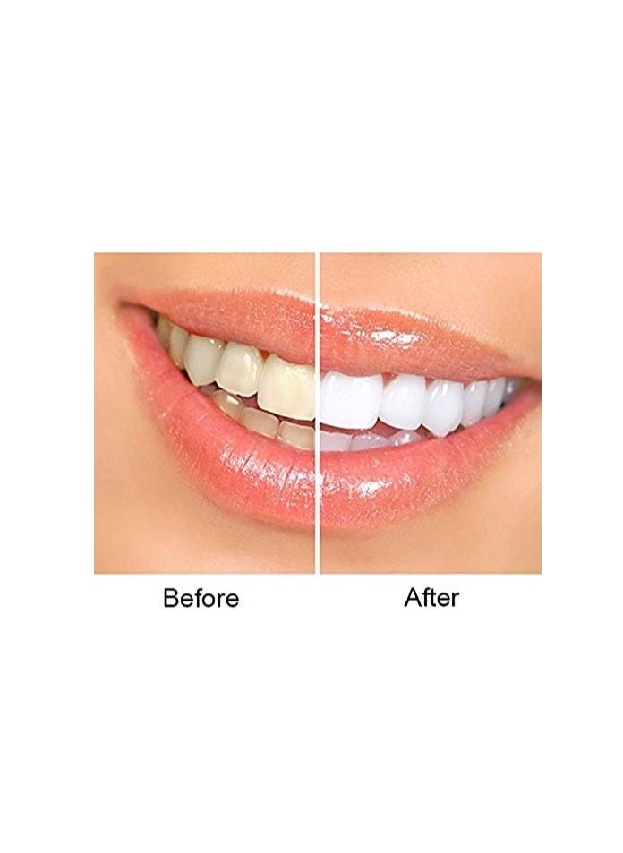 Grinigh - Complete Teeth Whitening Kit for Home use Gel 100% from USA Faster Results Than Tooth Whitening Strips Pen and Toothpaste Safe for Sensitive Teeth - Image 1