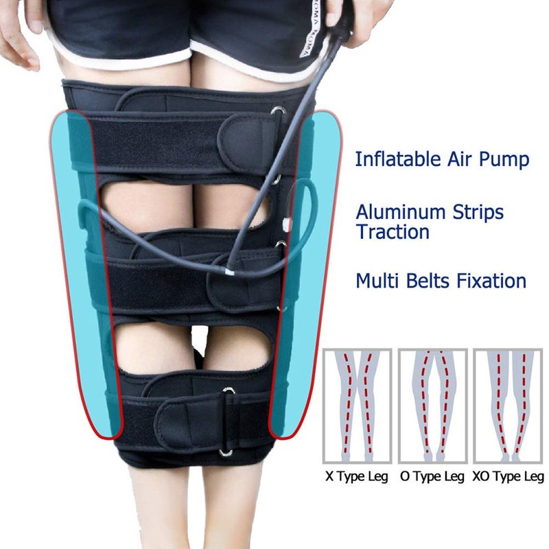 Balana O/X Leg Type Correction Belt,Knock Knee Braces,Knock Knees Valgus Deformity Bow Legs Band,Legs Posture Corrector Belt,Straighten Belt for Children and Adult - Image 2