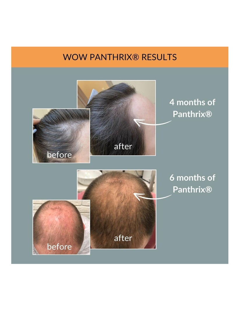 Panthrix Hair Growth Activator Made In Germany 100ml High-dose Spray Tonic For Quick Hair Growth Men & Women - Image 2