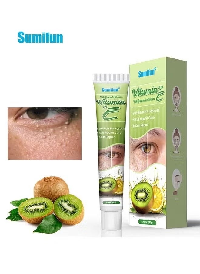 Sumifun Milia Removal Essential, Milia Spot Treatment Helps Dissolve And Reduce Milia, Whitehead And Sebaceous Hyperplasia 20G - Image 1