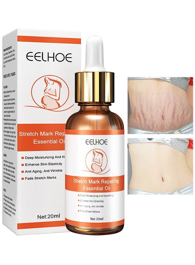EELHOE Stretch Marks Repairing Essential Oil, Stretch Marks And Scar Removal Oil For Pregnancy Stretch Marks Scar Belly Oil, For Wrinkles Obesity Stretch Mark Moisturizing Remove Marks 20ML - Image 1