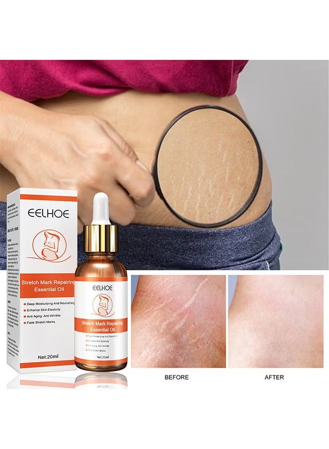 EELHOE Stretch Marks Repairing Essential Oil, Stretch Marks And Scar Removal Oil For Pregnancy Stretch Marks Scar Belly Oil, For Wrinkles Obesity Stretch Mark Moisturizing Remove Marks 20ML - Image 2