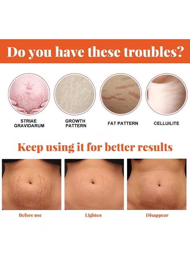 EELHOE Stretch Marks Repairing Essential Oil, Stretch Marks And Scar Removal Oil For Pregnancy Stretch Marks Scar Belly Oil, For Wrinkles Obesity Stretch Mark Moisturizing Remove Marks 20ML - Image 5