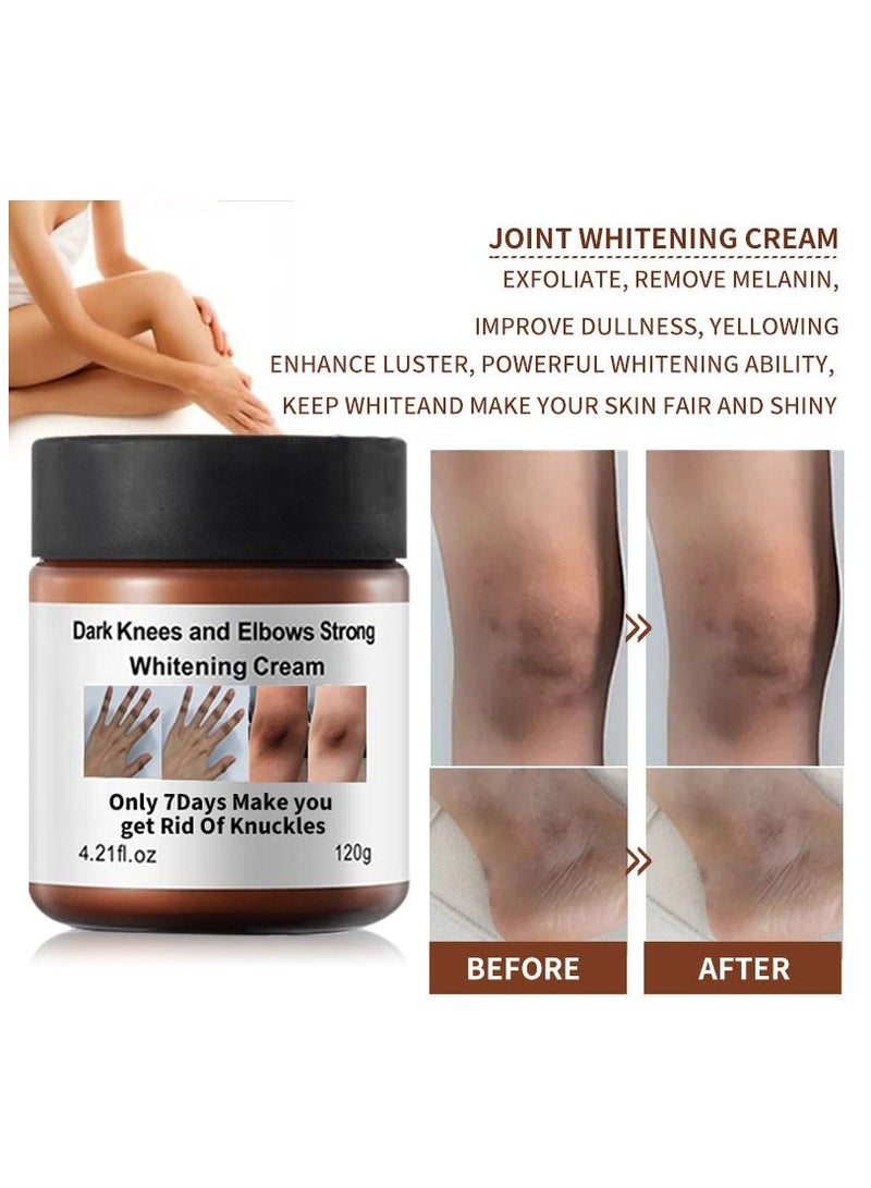 Dark Knees and Elbows Strong Whitening Cream 120g Get Rid of Knuckles Easily in Just 7 Days Skin Whitening Improve Skin Tone Nourishing and Moisturizing Cream