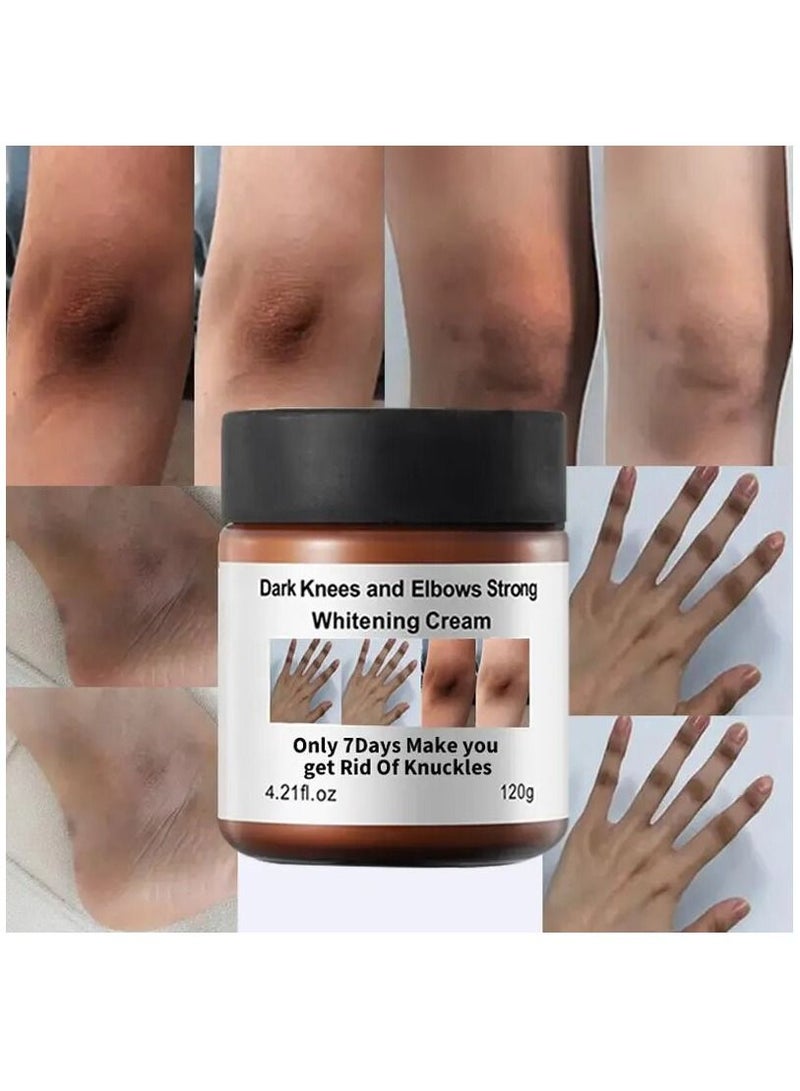 Dark Knees and Elbows Strong Whitening Cream 120g Get Rid of Knuckles Easily in Just 7 Days Skin Whitening Improve Skin Tone Nourishing and Moisturizing Cream