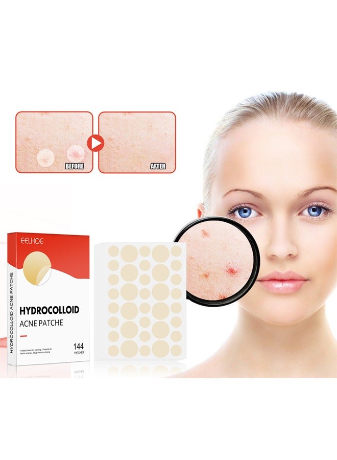 EELHOE 144 Patches Hydrocolloid Acne Patch, Invisible Makeup Closed Acne Patch,  Net Waterproof Breathable Acne Muscle Repair Patch, Effective for Blackheads, Whiteheads, and Closed Comedones  - Image 1