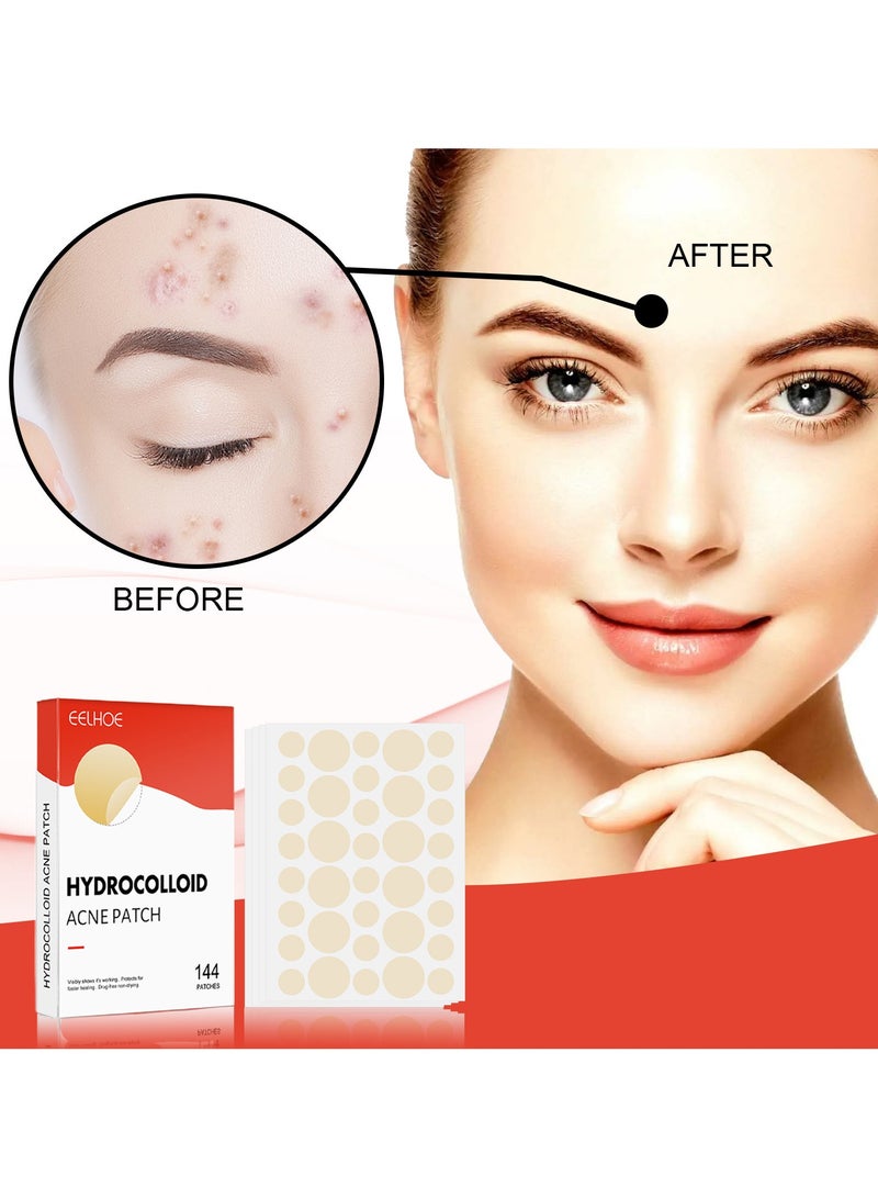 EELHOE 144 Patches Hydrocolloid Acne Patch, Invisible Makeup Closed Acne Patch,  Net Waterproof Breathable Acne Muscle Repair Patch, Effective for Blackheads, Whiteheads, and Closed Comedones - Image 1