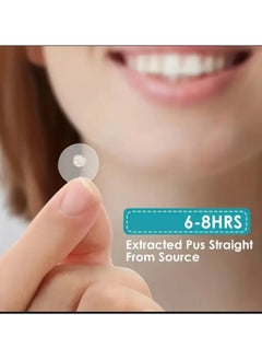 EELHOE 144 Patches Hydrocolloid Acne Patch, Invisible Makeup Closed Acne Patch,  Net Waterproof Breathable Acne Muscle Repair Patch, Effective for Blackheads, Whiteheads, and Closed Comedones  - Image 3