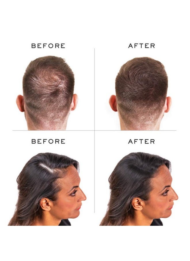 Nanogen Nanogen Hair Thickening Keratin Fibres Dark Brown  - Image 4