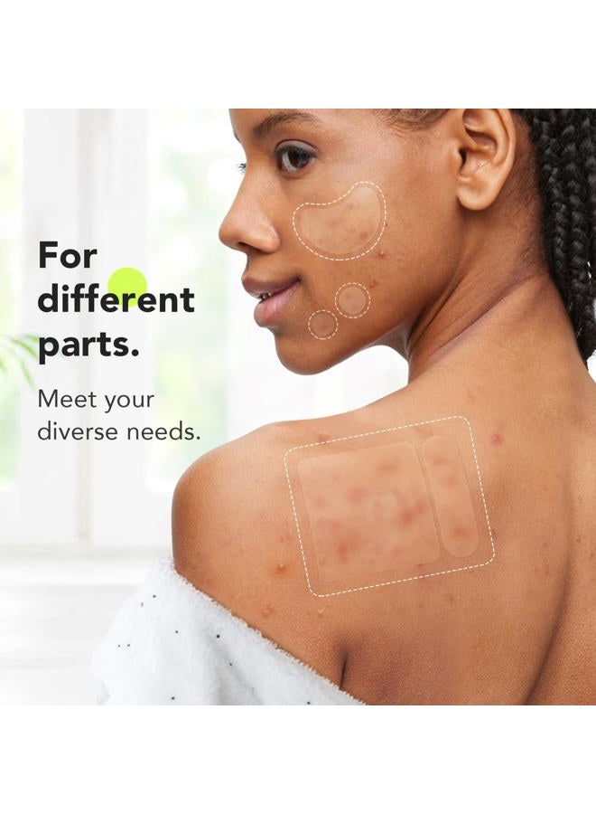 LitBear Large Pimple Patches (7 Sizes 112 Counts), Big Acne Patches, XL Hydrocolloid Bandages for Full Face, Forehead, Chin, Nose, Body, Back, Neck & Chest, Oval, Moon, Square hydrocolloid Patch  - Image 3