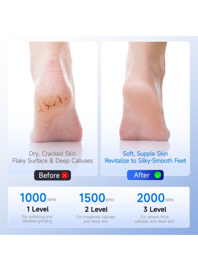 جهاز كهربائي جديد لإزالة مسامير القدم - Image 1