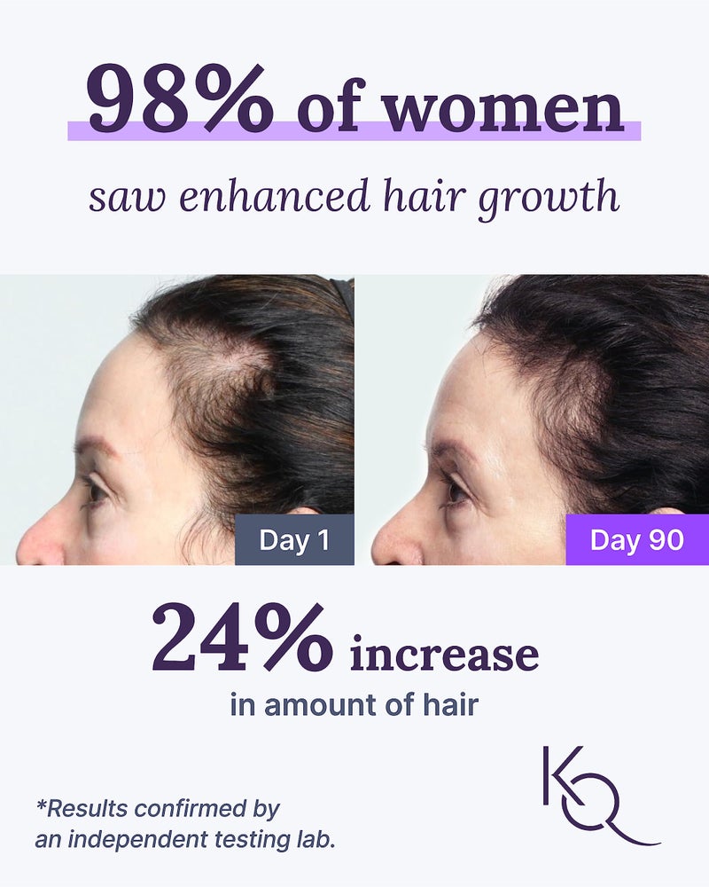 Keranique Hair & Scalp Supplements - Promote Strength and Growth Best for Thinning Nourish Your with Biotin, Vitamin B, More Vital Nutrients Keraviatin - Image 2