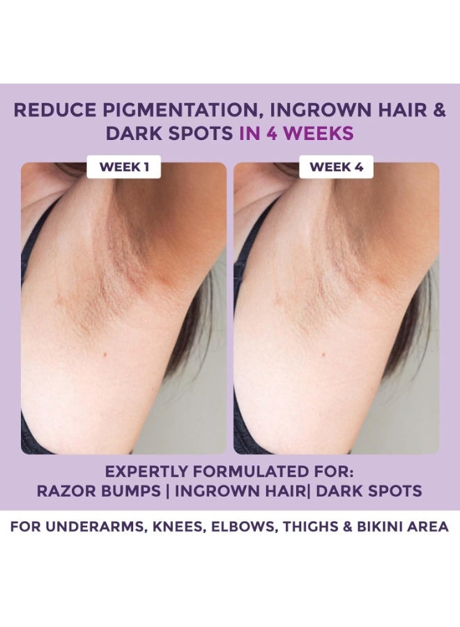 Sanfe Spotlite Ingrown Hair & Bumps Clearing Body Scrub For Dark Underarms, Inner Thighs And Sensitive Areas | 3X Quicker Penetration With Glycoclear | 10% Glycolic Acid, Walnut Beads | Helps in Depigmentation - 50gm, For Indian Women Skin - Image 2